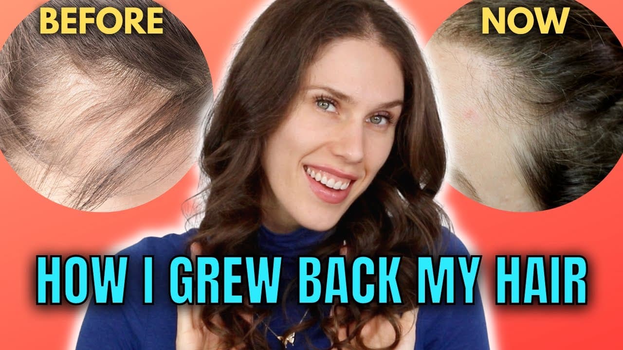 Descubre cómo el Hairvest puede transformar tu cabello y mejorar tu apariencia