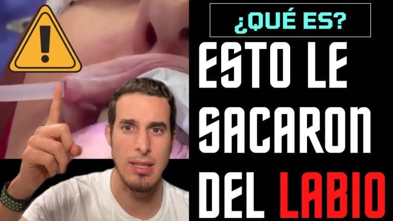 Luce labios de silicona irresistibles