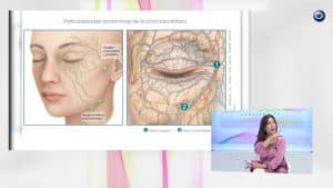 Teoxane ojeras: sesiones, resultados y cuidados previos